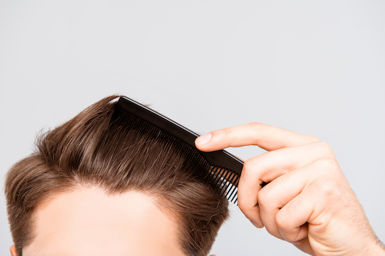 What causes these thin hair problems for men